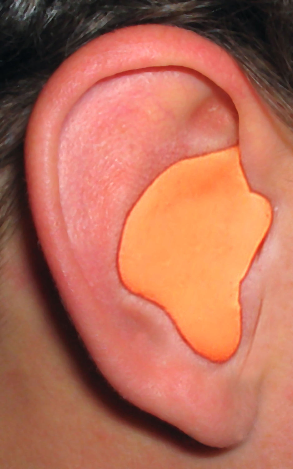 Custom Molded Earplugs - Blue