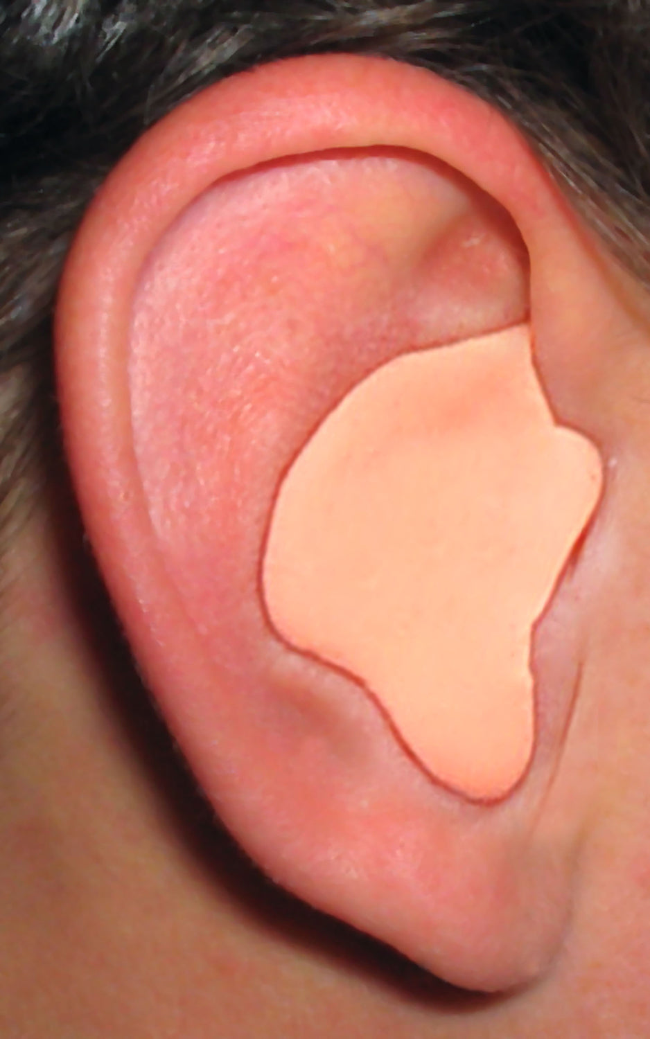 Custom Molded Earplugs - Blue