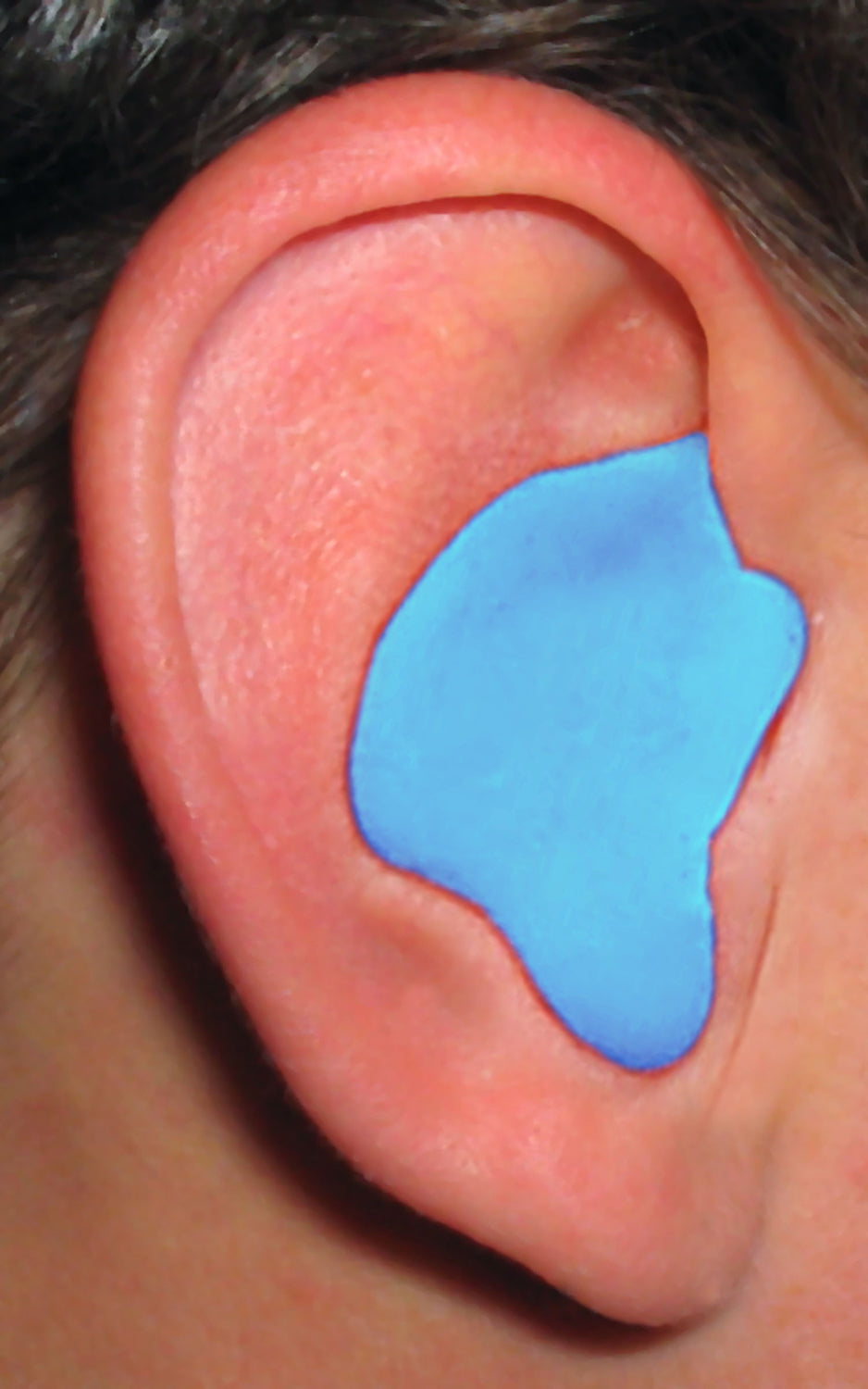Custom Molded Earplugs - Blue